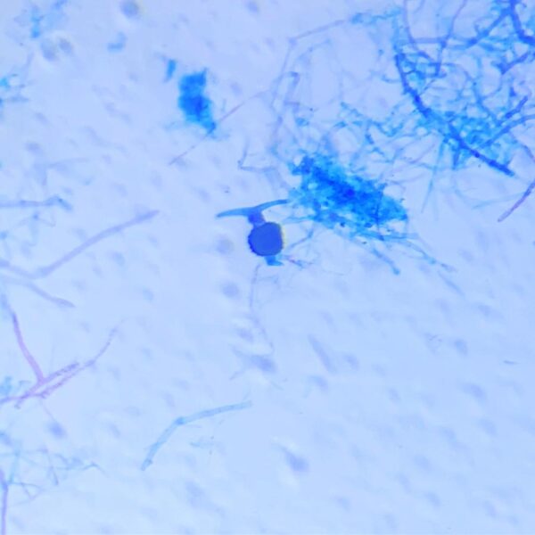 Mucor Zygote w.m. slides Code-405090
