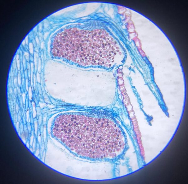 Lycopodium Mature Strobilus slides Code-405128