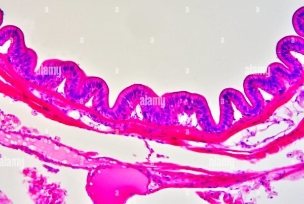 Earthworm Intestine Reg. c.s slides Code-506097