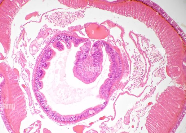 Earthworm seminel vesicle slides Code-506105