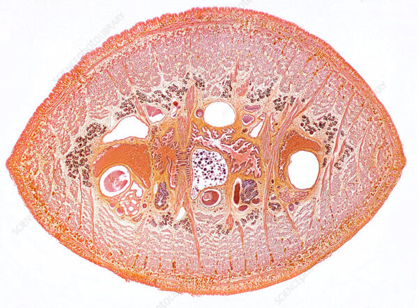 Leech Nephridia w.m. slides Code-506109