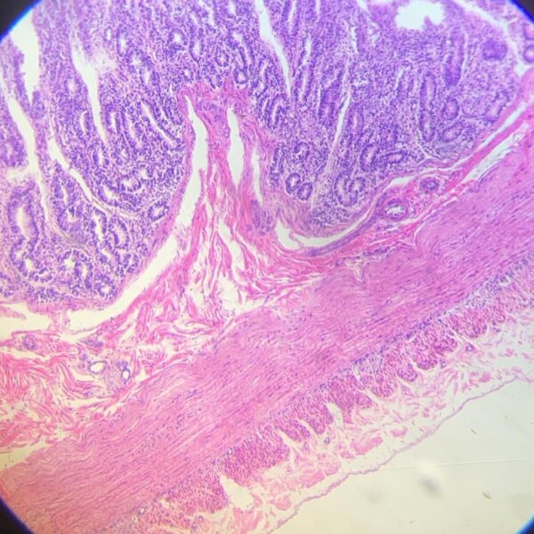 Duodenum c.s. slides Code-60290